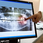 Digital x-rays are one of the ways that our Claremore dentists give patients the best treatment.