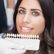 Dental veneers are matched to the natural shade of your teeth.