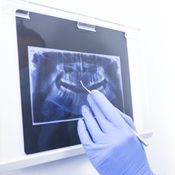 Digital x-rays are one of the advanced dental technologies offered at Flawless Smile Dentistry.